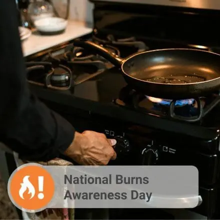 National Burns Awareness Day 2025 image
